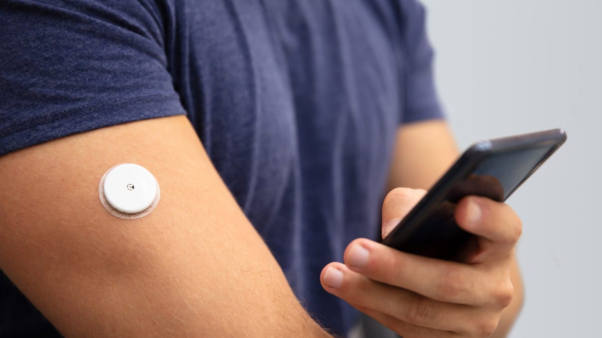 What is an OTC CGM? Overview, Brands, and Use Cases